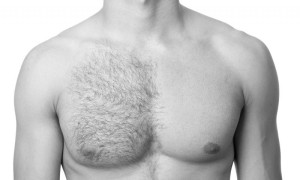 laser-hair-chest